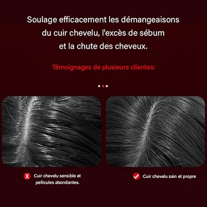 Red Light Scalp Massager